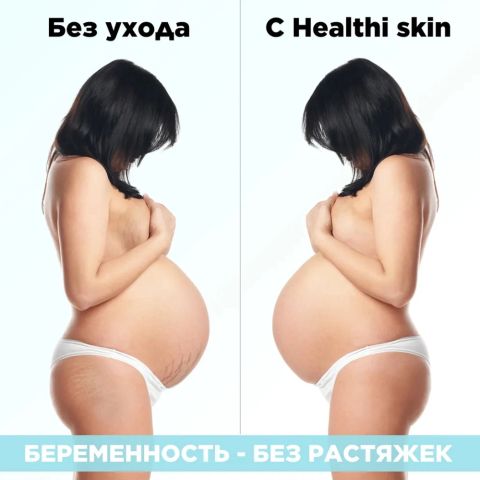 Масло от растяжек для беременных Healthy skin, 150 мл