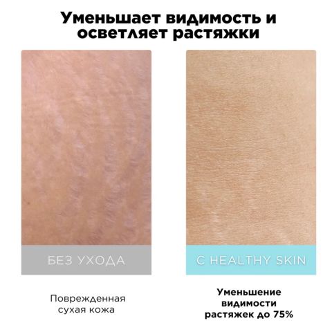 Масло от растяжек для беременных Healthy skin, 150 мл